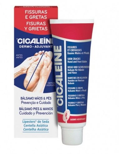 Cicaleïne Fisuras Pies y Manos