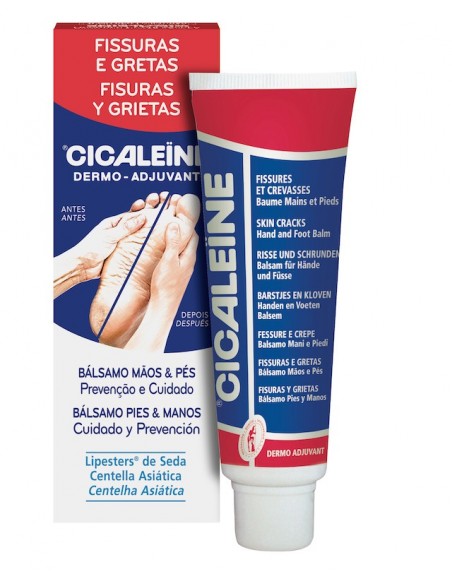 Cicaleïne Fisuras Pies y Manos